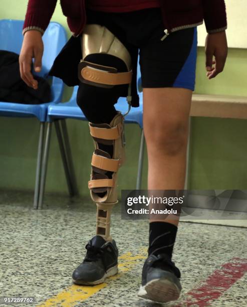 Child with a prosthetic leg is seen at a rehabilitation center in Erbil, Iraq on February 11, 2018. The rehabilitation center serves since 1996...