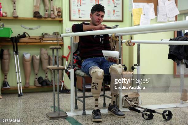 Youth, with prosthetic legs, sits on a chair at a rehabilitation center in Erbil, Iraq on February 11, 2018. The rehabilitation center serves since...