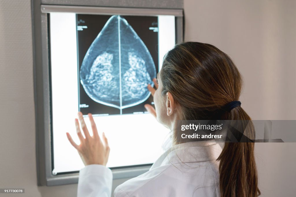 Ginecologo donna irriconoscibile che guarda una mammografia in ospedale