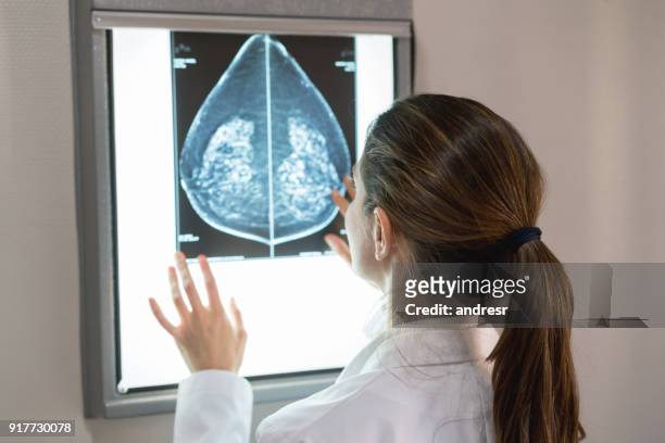 oigenkännlig kvinnliga gynocologist tittar på en mammografi på sjukhuset - cyst bildbanksfoton och bilder