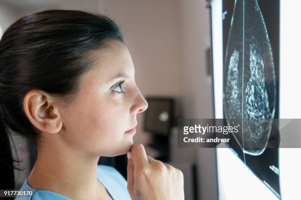 kvinnliga gynekolog tittar ett mammogram som är mycket oroade - cyst bildbanksfoton och bilder