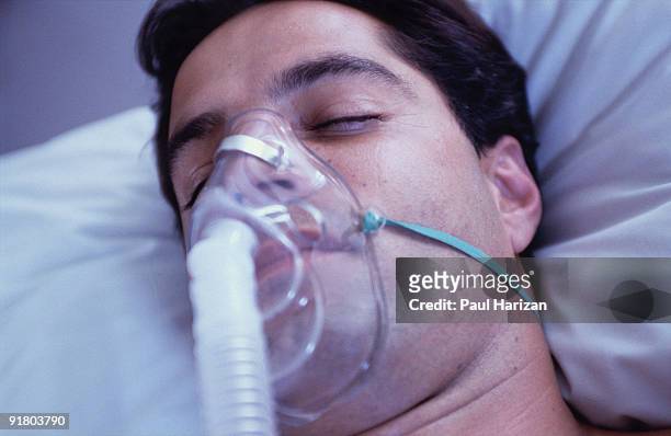 unconscious patient with oxygen mask - ventilator 個照片及圖片檔