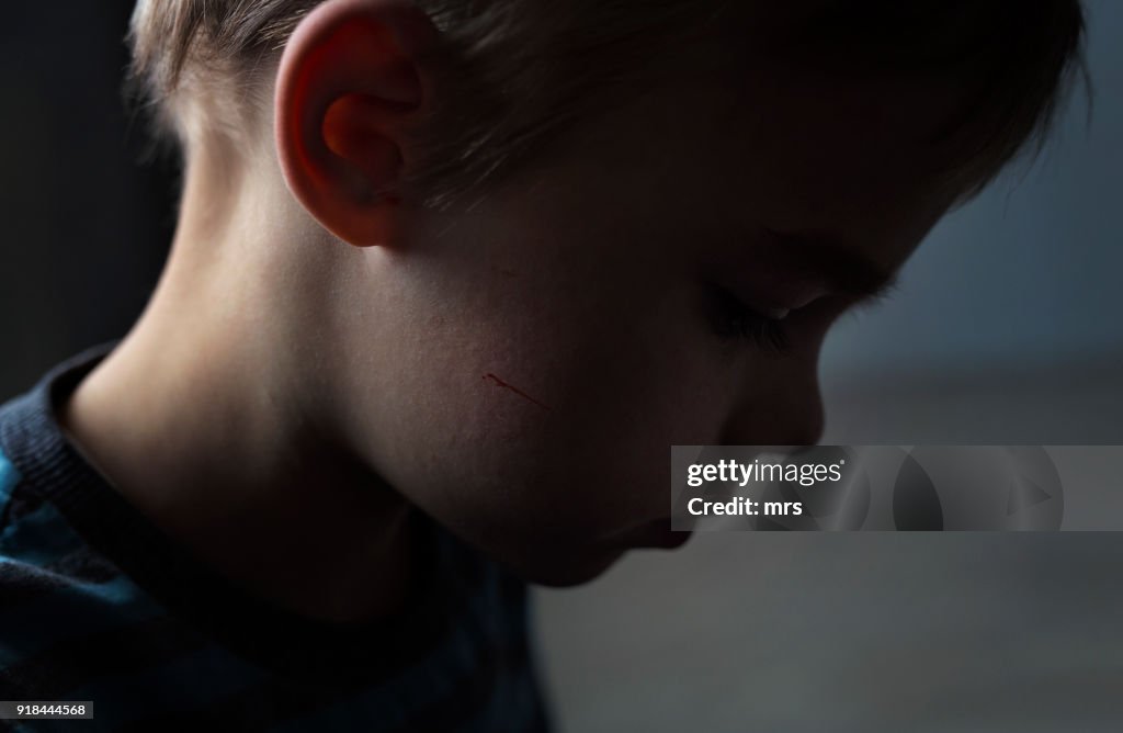 Child abuse