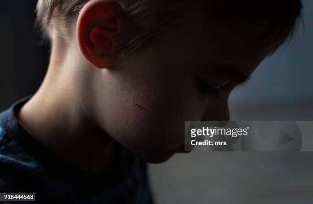 child abuse - scared boy imagens e fotografias de stock