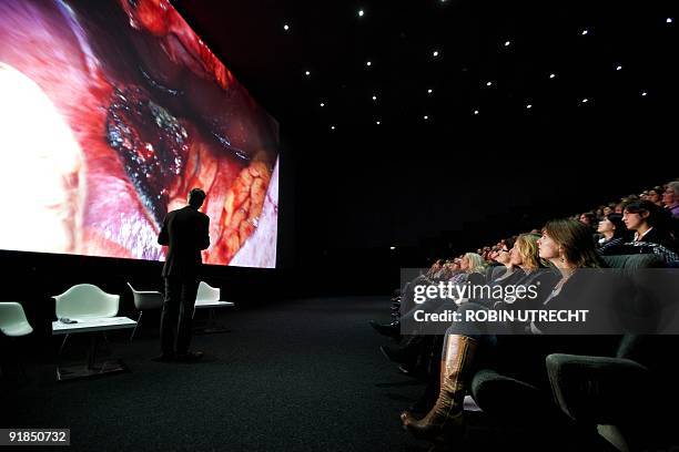 Spectators watch live liver surgery to remove a tumor at the Pathe cinema in Rotterdam on October 13, 2009. The surgery was filmed by a video...