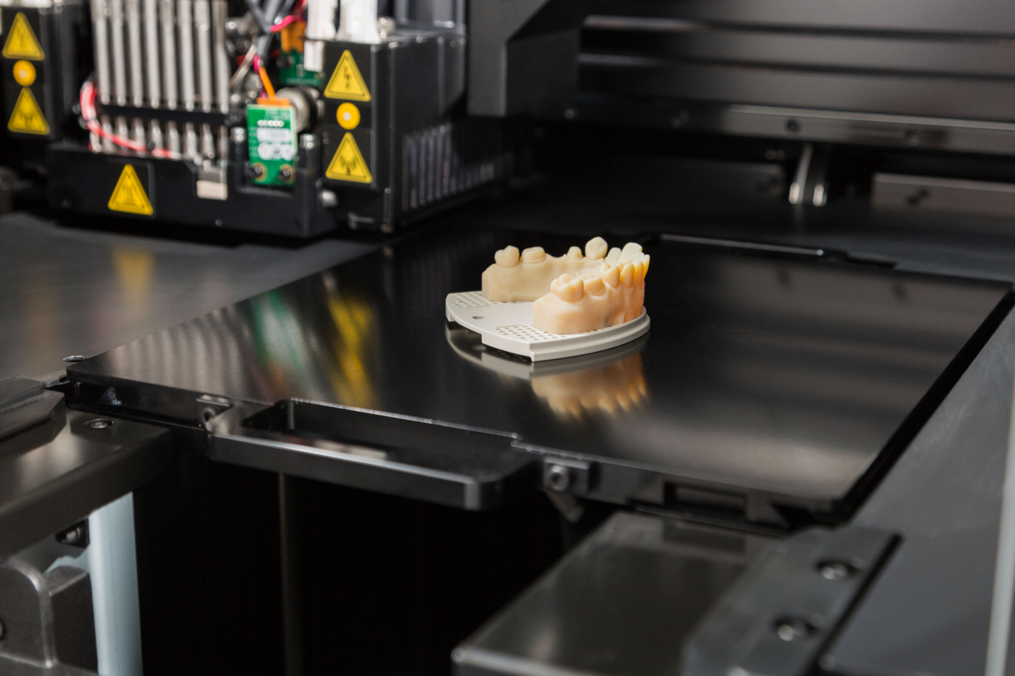 3d printing dental
