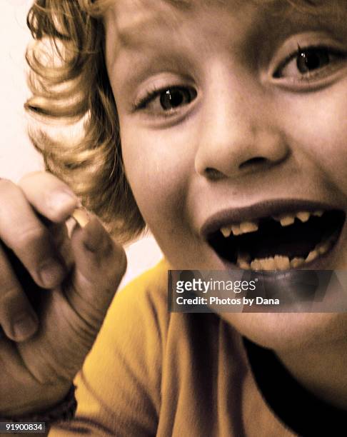boy missing tooth - losing virginity stock-fotos und bilder