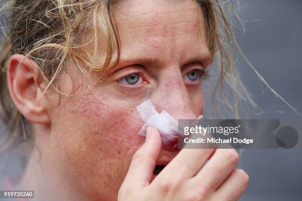 Cora Staunton of GWS looks on after sustaining a nose injury during the round three AFLW match between the Collingwood Magpies and the Greater...