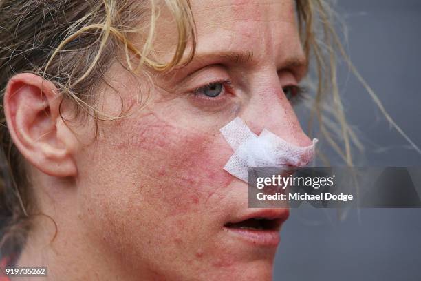 Cora Staunton of GWS looks on after sustaining a nose injury during the round three AFLW match between the Collingwood Magpies and the Greater...