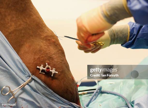 Equine Surgeon Phil Cramp stiches the wound following successful key-hole surgery on the leg of a racehorse during an operation at the Hambleton...