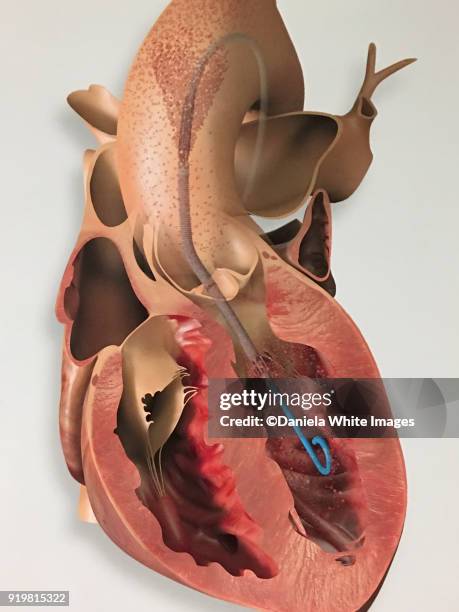 heart - heart ventricle fotografías e imágenes de stock