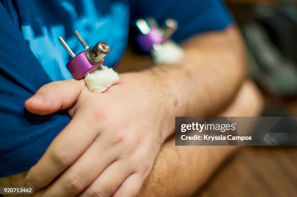 man suffering from broken wrist and arm with titanium external fixator - surgical pin stock pictures, royalty-free photos & images