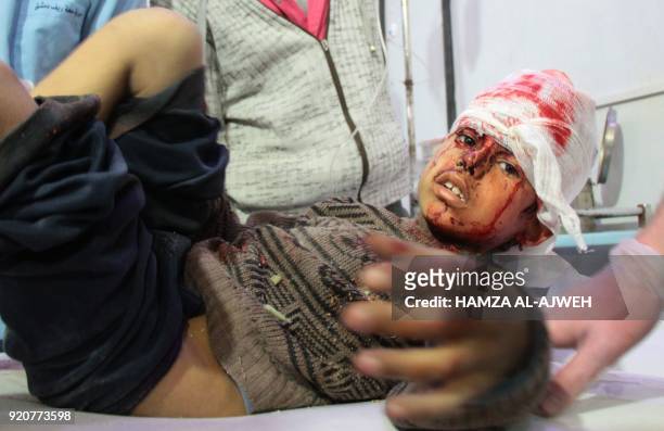 Graphic content / A wounded Syrian boy receives treatment at a make-shift hospital in Douma following air strikes on the Syrian village of Mesraba in...