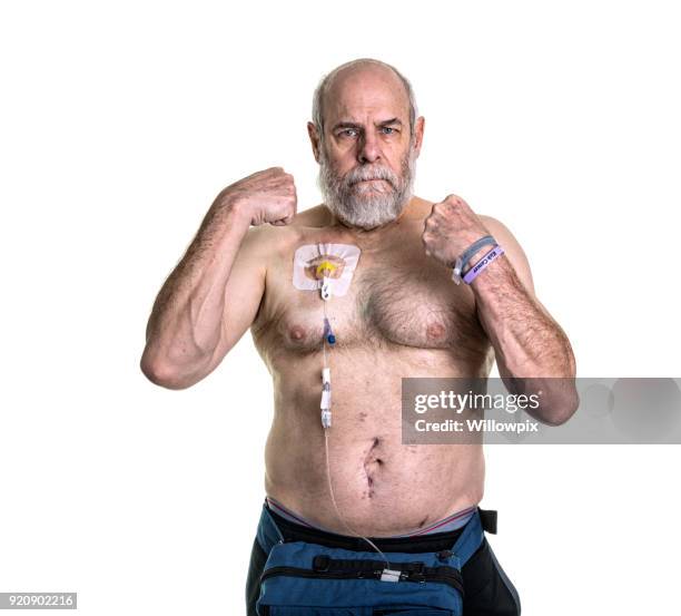 senior man medische patiënt vechten kanker herhaling met chemotherapie behandeling - menselijke dunne darm stockfoto's en -beelden