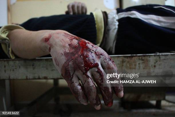 Graphic content / A wounded Syrian lies on a gurney inside a makeshift hospital in the rebel-held town of Douma, following air strikes by regime...