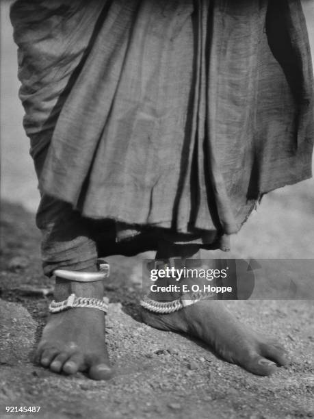 Ankle jewellery on a Sudra or Shudra woman in Guntakal, Andhra Pradesh, 1929.