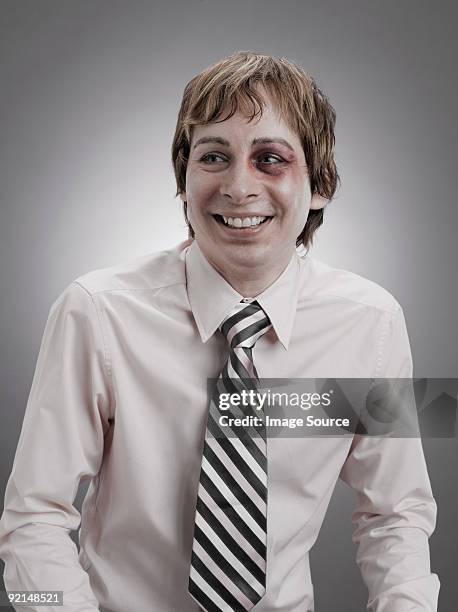 portrait of a man with a black eye - blaues auge stock-fotos und bilder