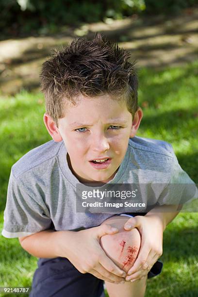 boy with a grazed knee - human knee stock pictures, royalty-free photos & images