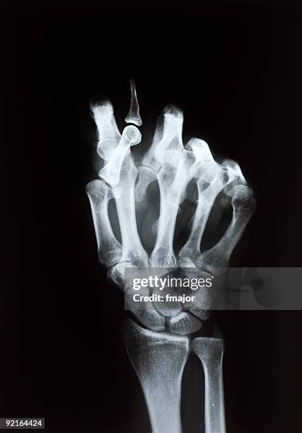 f *ck que - xray fist fotografías e imágenes de stock