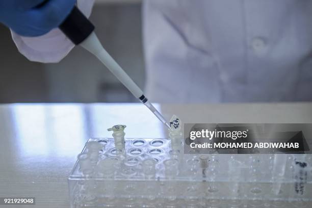 Photo taken on January 24, 2018 shows lab tecnicians demonstrating DNA testing at the Puntland Forensic Center in Garowe, Puntland State, Somalia. -...