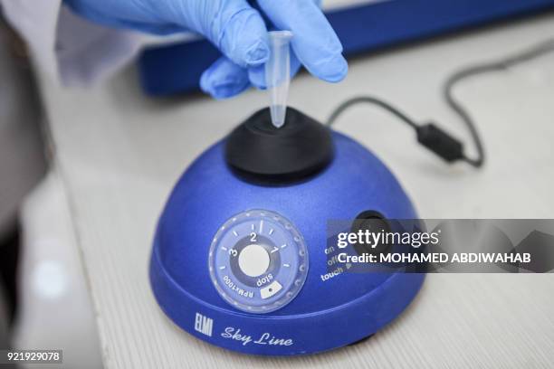 Photo taken on January 24, 2018 shows lab tecnicians demonstrating DNA testing at the Puntland Forensic Center in Garowe, Puntland State, Somalia. -...