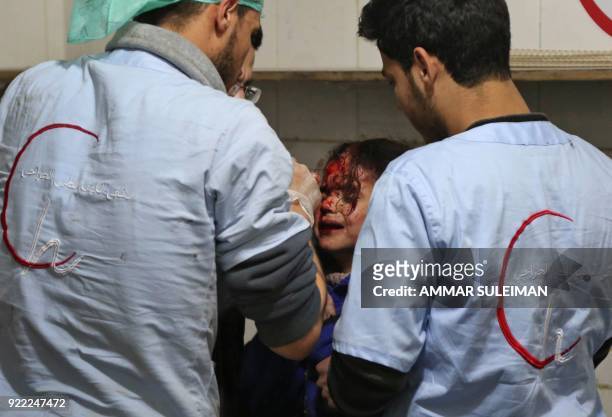 Wounded Syrian girl receives treatment at a make-shift hospital in Kafr Batna following Syrian government bombardments on the besieged Eastern Ghouta...