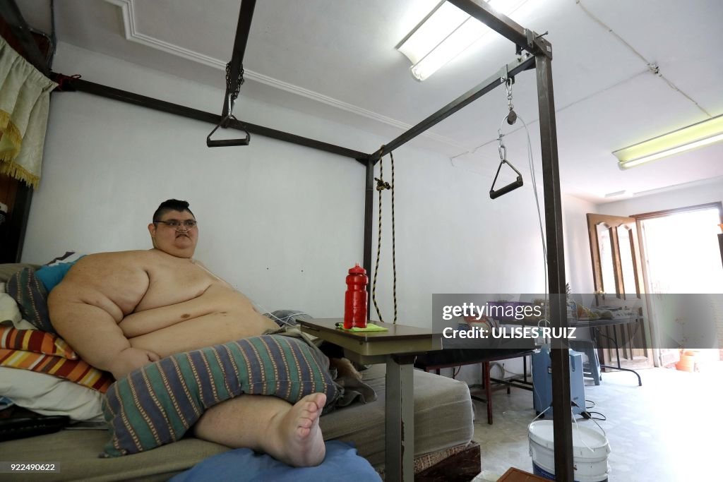 TOPSHOT-MEXICO-HEALTH-OBESITY