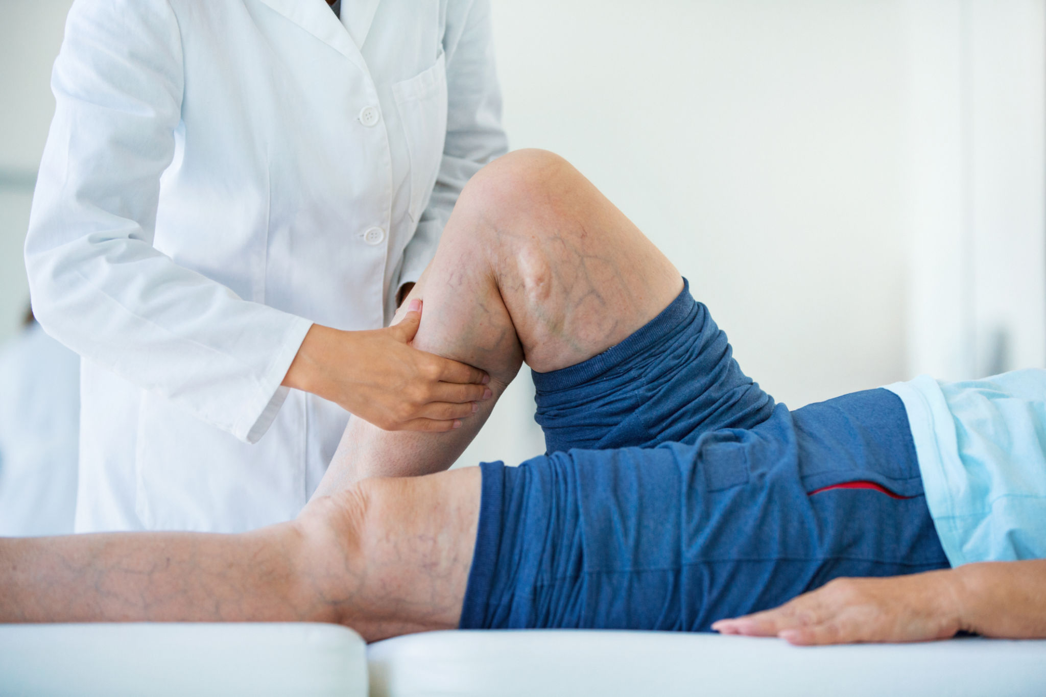 vein treatment