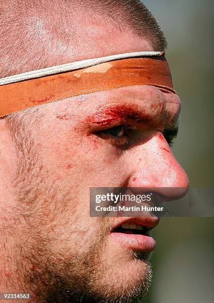 Shannan McRae of South Canterbury leaves the field with a cut above the eye during the Heartland Championship Semi-Final match between Mid Canterbury...