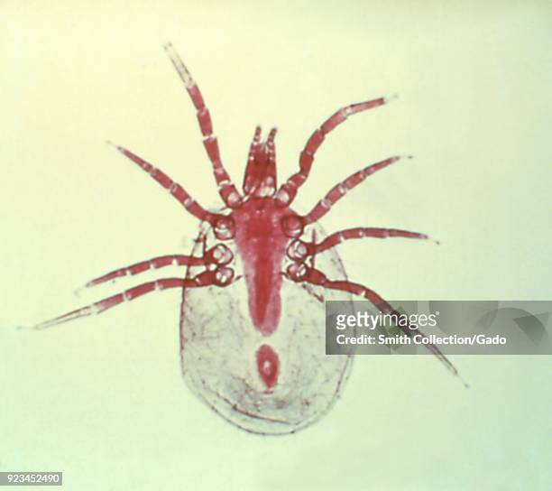 Mite, a member of the Class Arachnida, and the Order Acari, 1972. Image courtesy Centers for Disease Control .