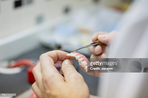 making a dental prosthesis - prosthetic stock pictures, royalty-free photos & images