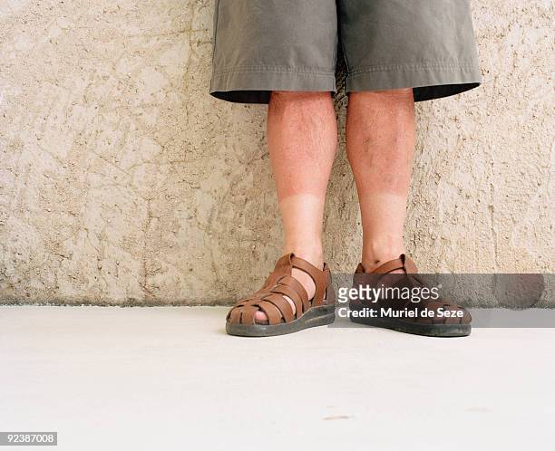 men legs with sun burn - sandales photos et images de collection
