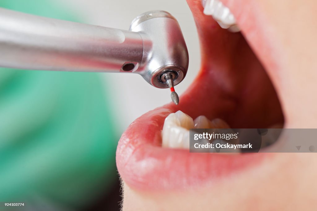 Dental treatment close up