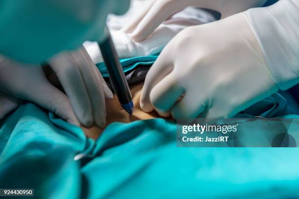 doctors in scrubs operating on a patient using instruments - surgical pin stock pictures, royalty-free photos & images