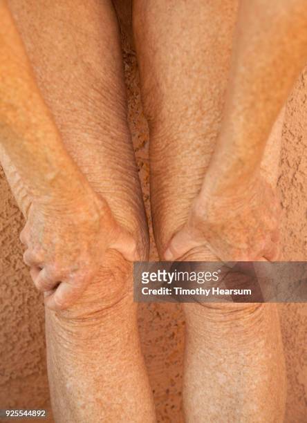 close-up view of an older woman's legs with hands grasping her knees - timothy hearsum fotografías e imágenes de stock