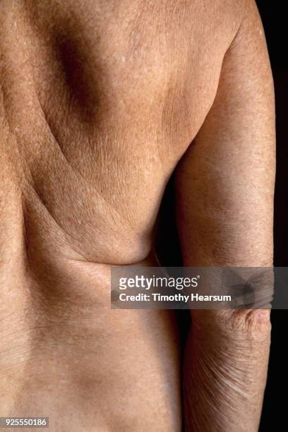 close-up view of the right side of an older woman's back and right arm showing age-related wrinkles and creases - timothy hearsum stock-fotos und bilder