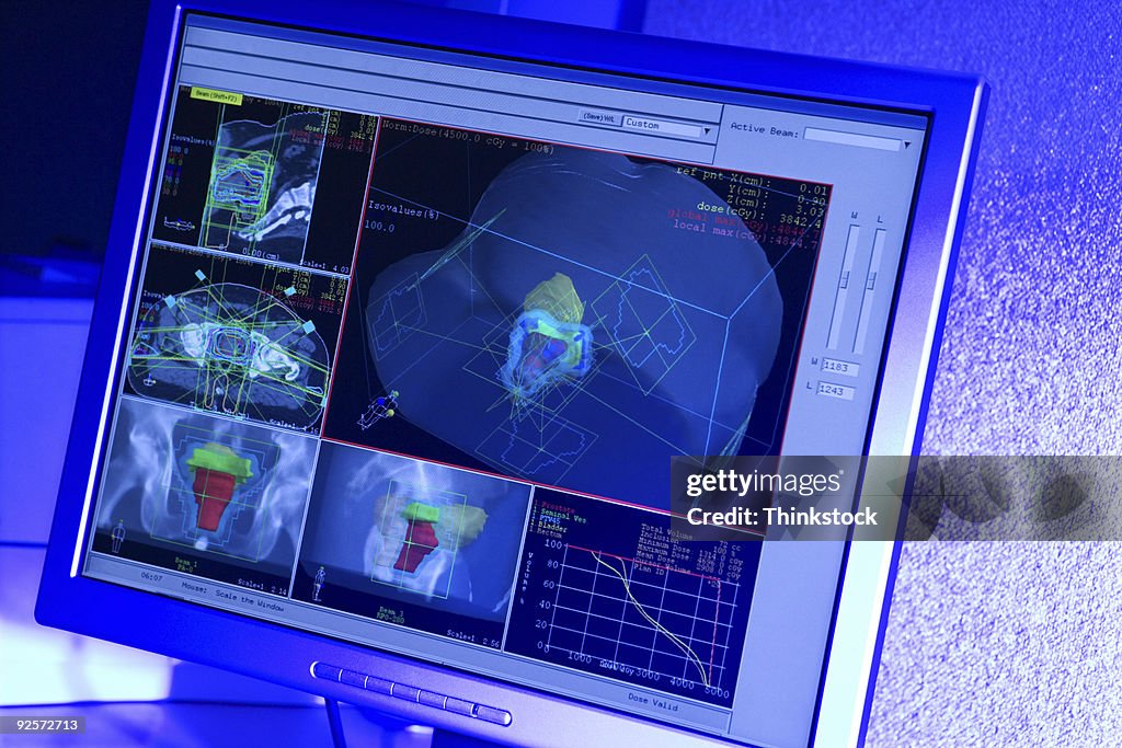 Medical Scans On Computer Monitor High-Res Stock Photo - Getty Images