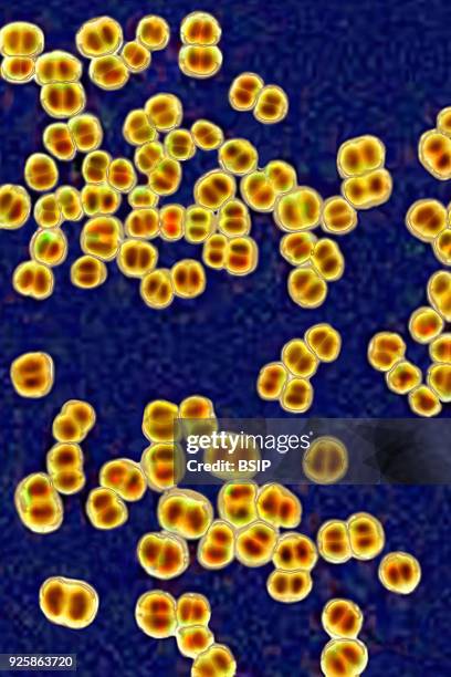 Meningococci, Neisseria Meningitidis, the bacteria in meningitis. Seen under optical microscopy X 1000.