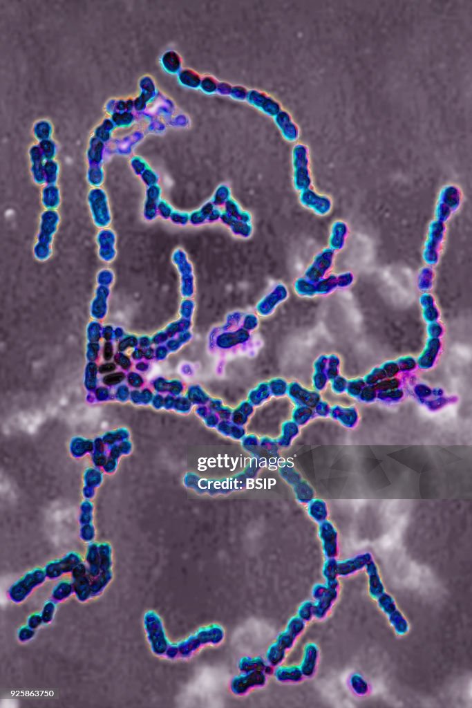 Streptococcus pyogenes A. Bacteria responsible for skin infections ...