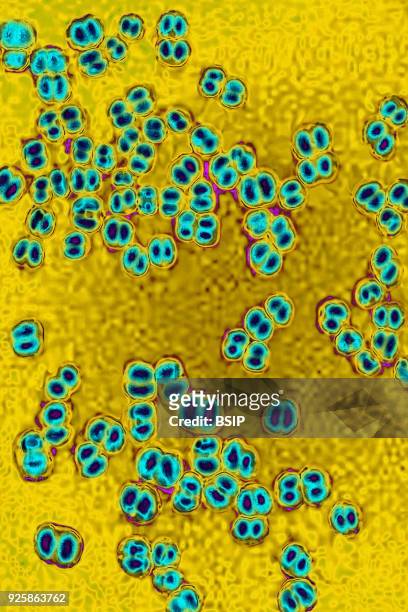 Meningococci, Neisseria Meningitidis, the bacteria in meningitis. Seen under optical microscopy X 1000.