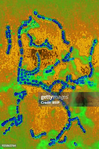 Streptococcus pyogenes A. Bacteria responsible for skin infections, impetigo, abscesses and bronchial-pulmonary infections. Seen under optical...