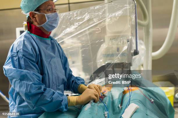 Radiofrequency ablation of cardiac arrhythmia using the Stereotaxis robotic system, by inserting a catheter into the heart, emitting radio waves that...