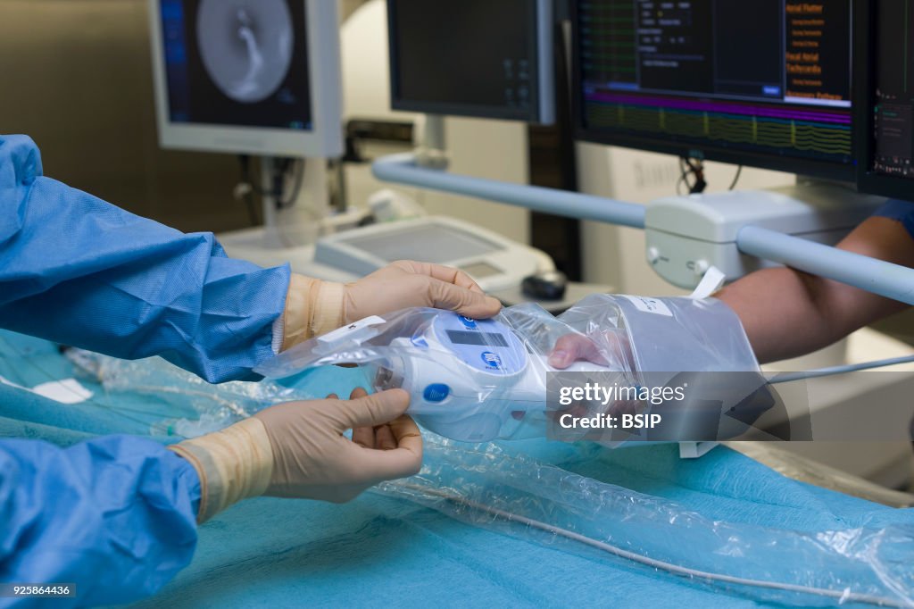 Radiofrequency Ablation