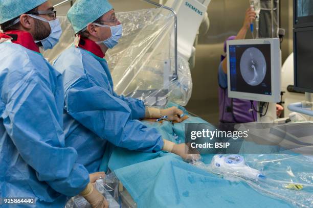 Radiofrequency ablation of cardiac arrhythmia using the Stereotaxis robotic system, by inserting a catheter into the heart, emitting radio waves that...