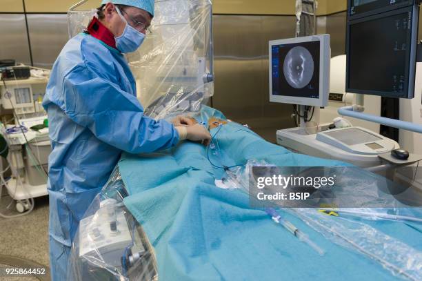 Radiofrequency ablation of cardiac arrhythmia using the Stereotaxis robotic system, by inserting a catheter into the heart, emitting radio waves that...