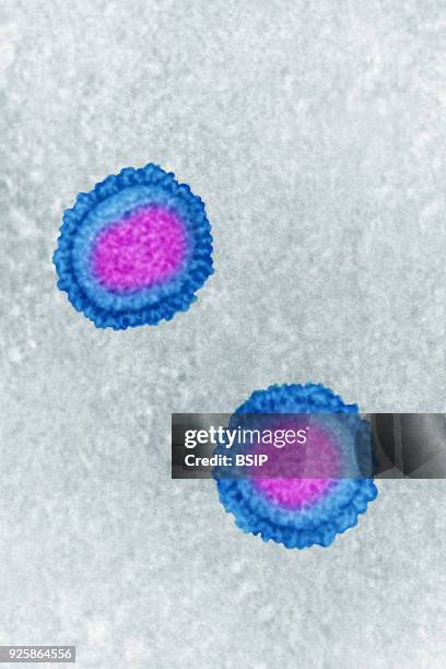 Influenza virus, Myxovirus influenzae, from the Orthomyxoviridae family. Viral diameter from 80 to 120 nanometers, taken using transmission electron...