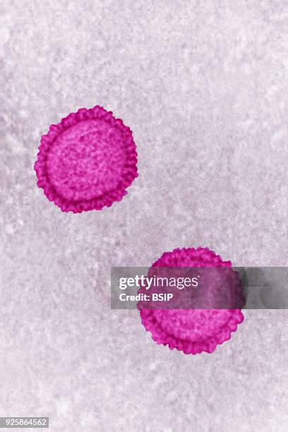 Influenza virus, Myxovirus influenzae, from the Orthomyxoviridae family. Viral diameter from 80 to 120 nanometers, taken using transmission electron...