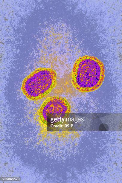 Influenza virus, Myxovirus influenzae, from the Orthomyxoviridae family. Viral diameter from 80 to 120 nanometers, taken using transmission electron...