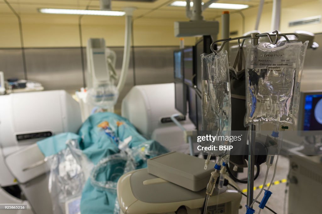 Radiofrequency Ablation