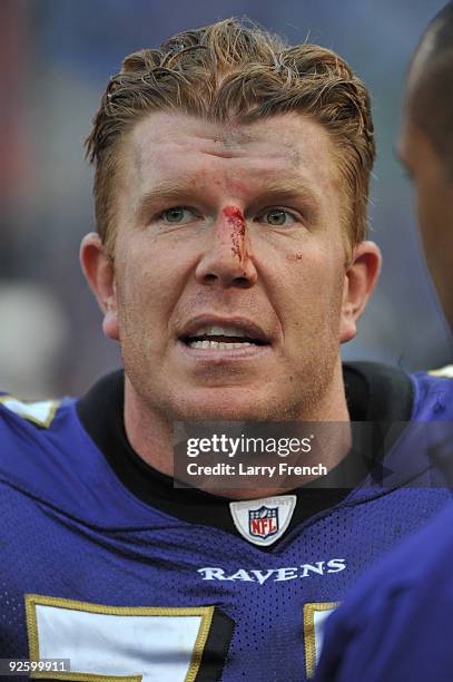 Matt Birk of the Baltimore Ravens bleeds on the sidelines during the game against the Denver Broncos at M&T Bank Stadium on November 1, 2009 in...